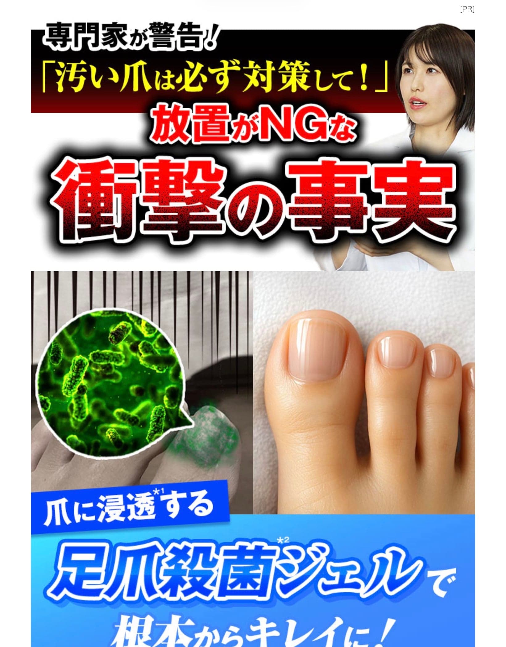 専門家が警鐘！「汚い爪は必ず対策して！」放置がNGな衝撃の事実 の関連画像 2