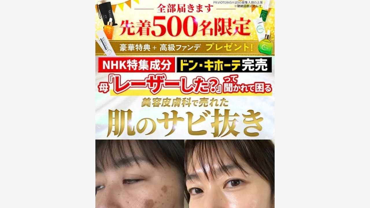 https://vioteras-c.jp/article/vioteras-y2/?gad_source=2&gad_campaignid=23939893150&gclid=CjwKCAjwpefSBhBvEiwAzyEtZ9Exw5d_4kIEoc-jTeDKbKa6k3Uj63ZtIqA-HFhFEVse4cT_VxSKgxoC8cYQAvD_BwE の関連画像 4