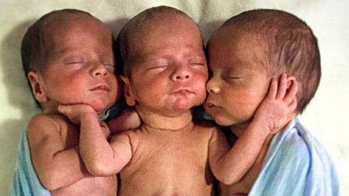 三つ子の顔を見た医師は、自分の目を疑った！ の関連画像 1