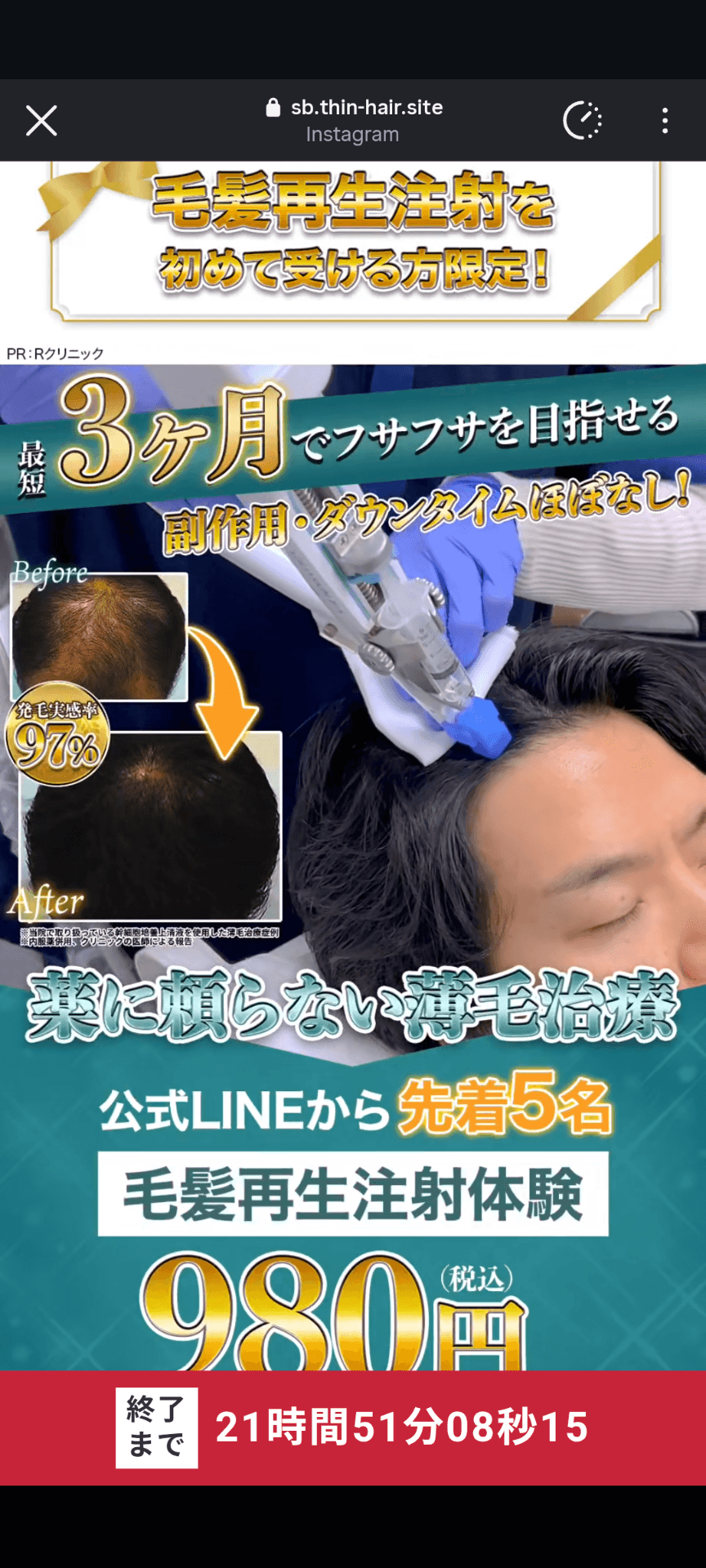https://sb.thin-hair.site/ab/irhsn2-14?fbclid=PAb21jcAUvZ0BleHRuA2FlbQEwAHBkb2YCYWRpZAGrNaV0a9VAc3J0YwZhcHBfaWQPNTY3MDY3MzQzMzUyNDI3AAGnlW-hSUVwe05Jnbj0i5oKfHKxRC7WUOtouEwH1haf9ZpLAXLCtmK86cCOQuo_aem_W4HWWW00ZcxanQzcAzZPDw&utm_medium=paid&utm_source=ig&utm_id=120247656507420080&utm_content=120247656508480080&utm_term=120247656507820080&utm_campaign=120247656507420080 の関連画像 1