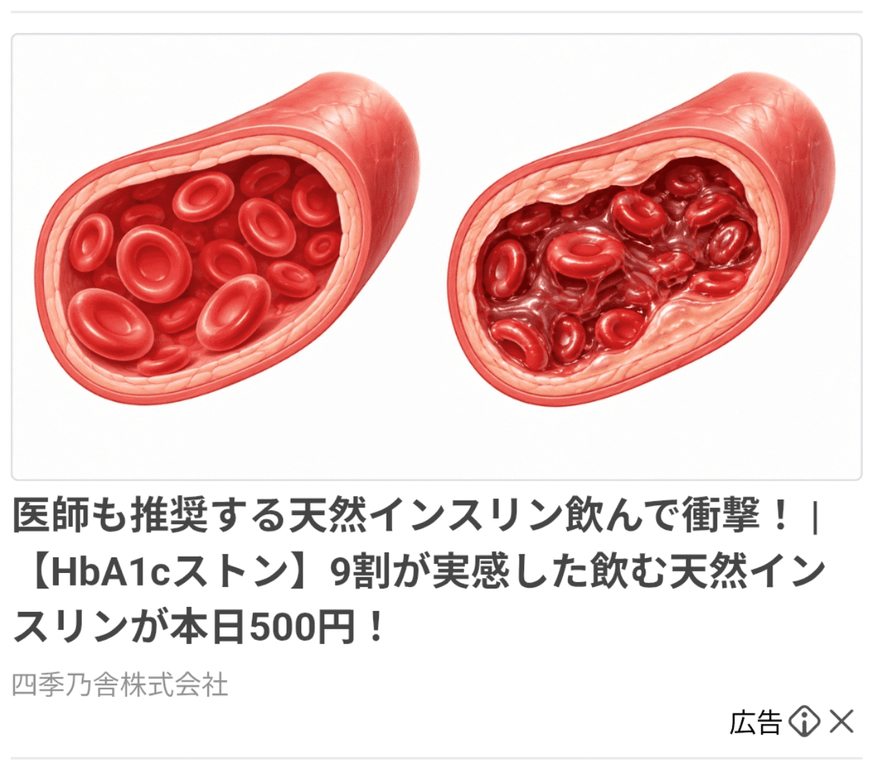 https://sb-tokan-proness.ourpage.jp/ab/sl-yda-002?yclid=YJAD.1789382062.A67Np2oAAMk7vn4Ngg5SSVuL7GbaQ1-KQIsOyISnoEpz6XamT0saj8MQcJUobCxE6UtwtjSuw6rfuUG1SuniF80npfgSov8L1EBy-3chSTMxlgHfSWP2ENHZX9x2SqhlE1uIFVKpdaVGoYxZME1gT6LS4bS_D21LV2jXkar-WHb_P60IONjspbXdIVhnUBa9oA&yj_r=014&_ly_c=5f086cf1-3561-4aa0-8de7-c5c1204b89f4&_ly_r=014&_ly_src=da の関連画像 1