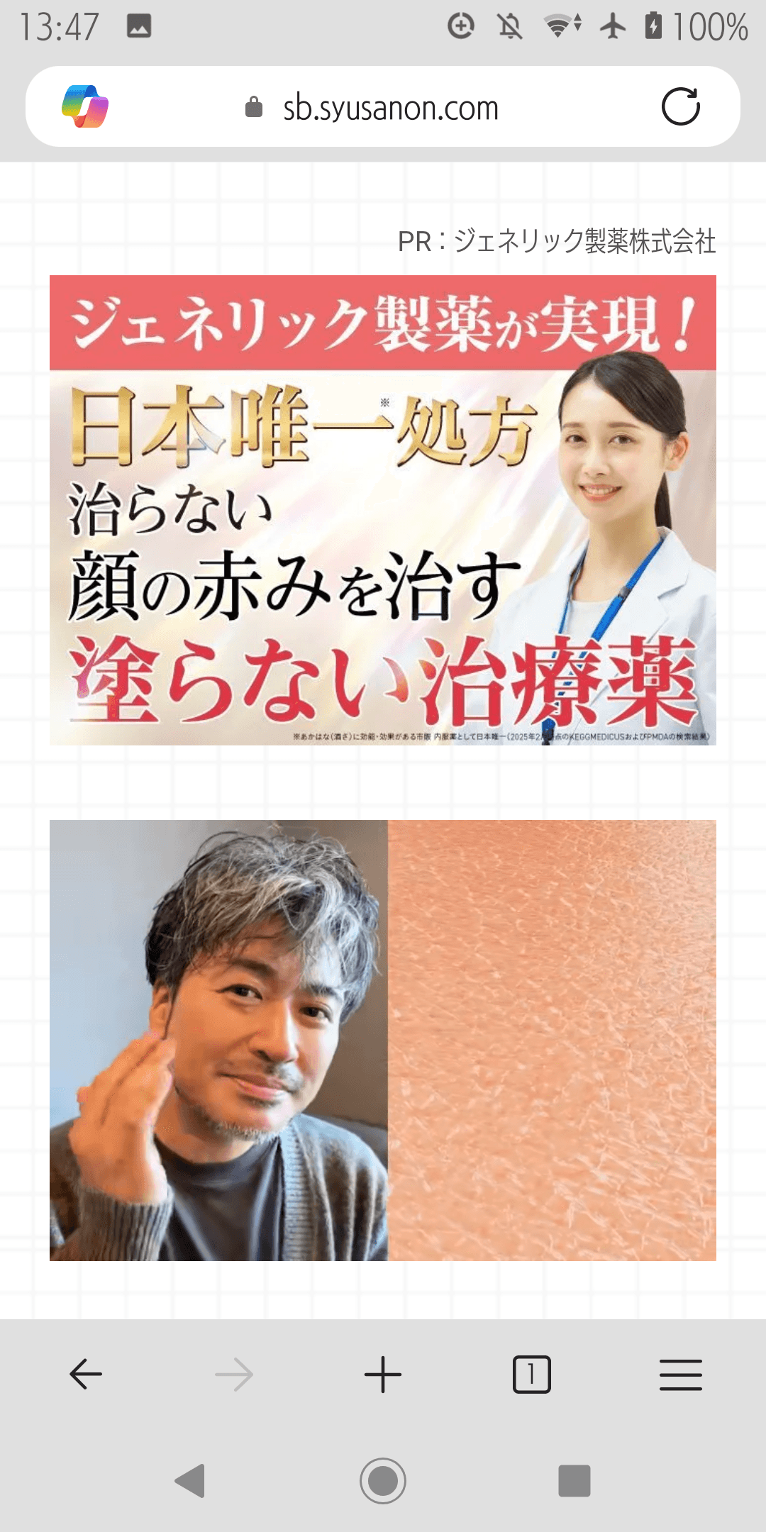 シュサノン内服錠公式WEB初回限定価格ページ｜ジェネリック製薬 の関連画像 1