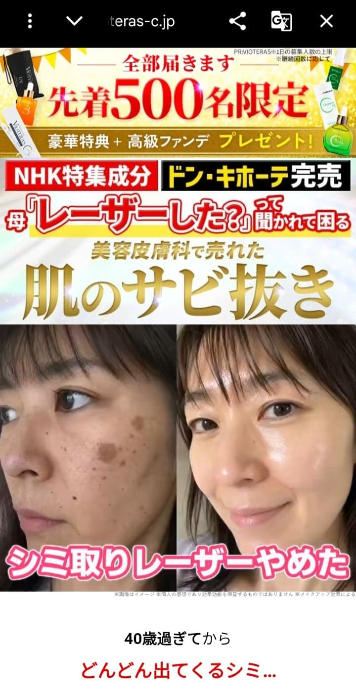 https://vioteras-c.jp/article/vioteras-y2/?gad_source=2&gad_campaignid=23939893150&gclid=CjwKCAjwpefSBhBvEiwAzyEtZ9Exw5d_4kIEoc-jTeDKbKa6k3Uj63ZtIqA-HFhFEVse4cT_VxSKgxoC8cYQAvD_BwE の関連画像 3